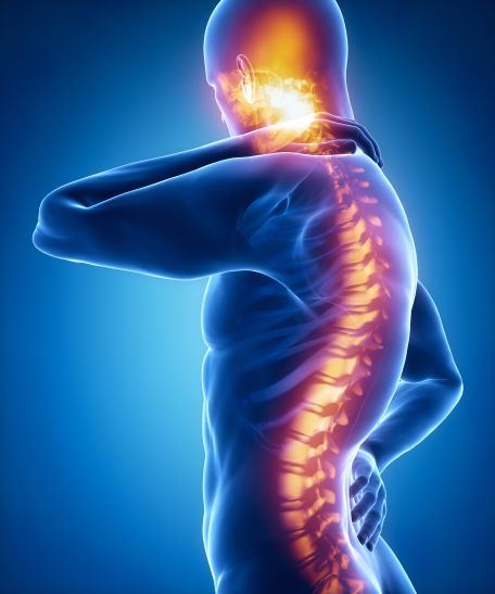 Spinal Cord Injury Case